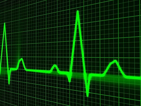 Photo of cardiac monitor display for illustrative purposes only