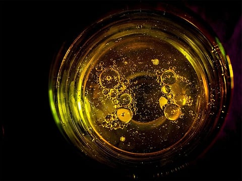 Representational image.