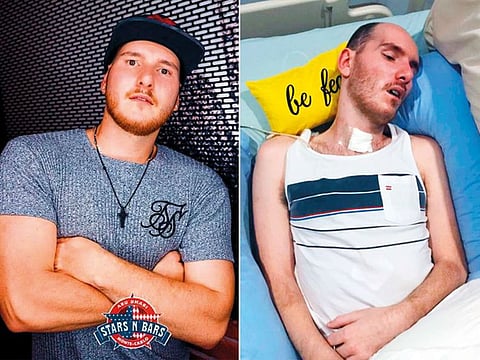 Tristan before and after taking the unprescribed supplements given to him by members  of a gym he frequented. The insulin supplements sent him into a hypoglycaemic coma.