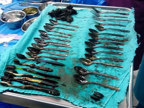 Items recovered from his stomach