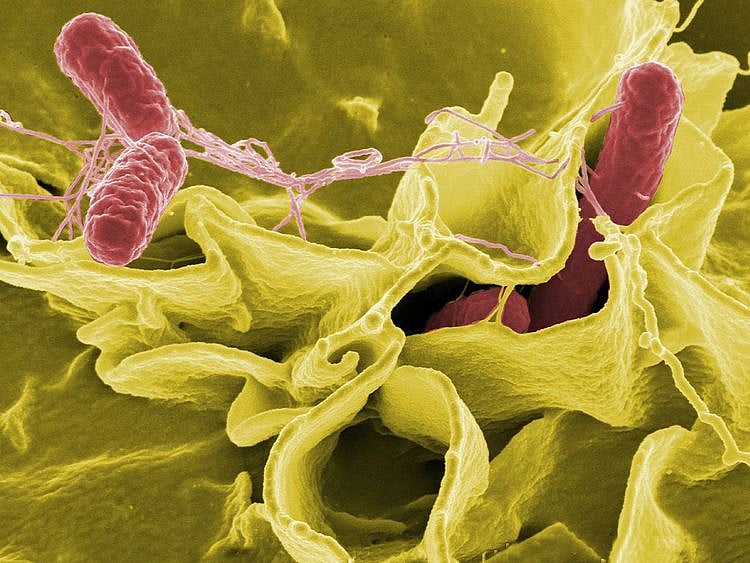 Salmonella bacteria.