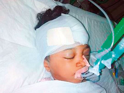 Three-year-old Haniyya sustained a head injury and multiple fractures in the traffic accident