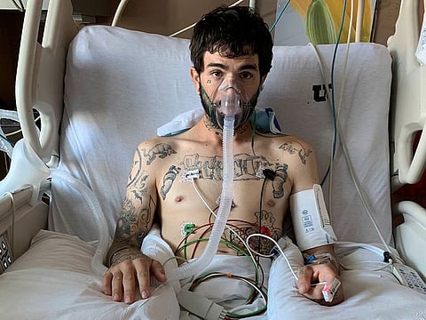 Jeffrey Manzanares, 33, lies in the intensive care unit of the University of Utah Hospital while being treated for vaping injury and other lung infections in Salt Lake City, Utah, U.S. in September 2019 and provided October 10, 2019. 