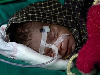 This miracle baby survived several days in her grave after being buried alive in India 