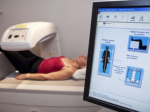 Osteoporosis is not an old age problem