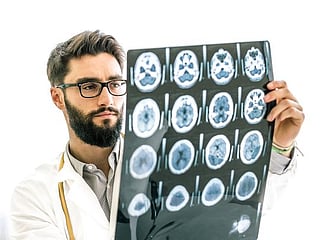 The differences between stroke and aneurysm