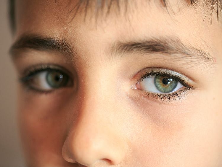 Zulekha Hospital Colour blindness