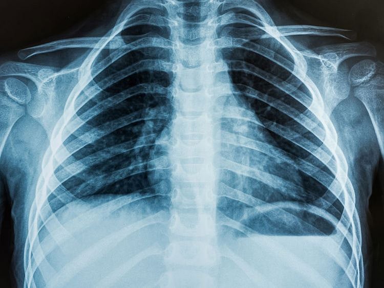 x-ray generic