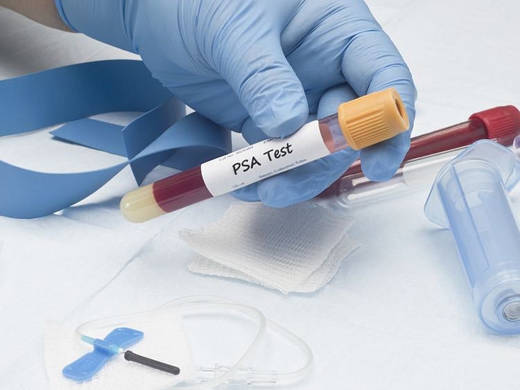 NAT 191129 prostate cancer-1575037187352