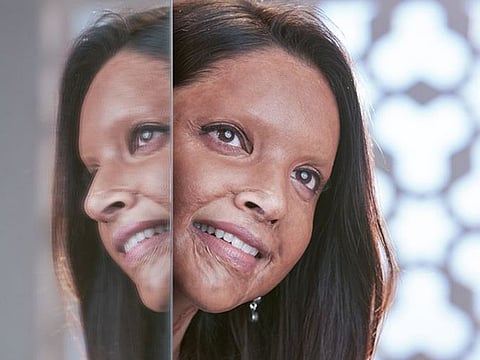 Deepika Padukone in 'Chhapaak'