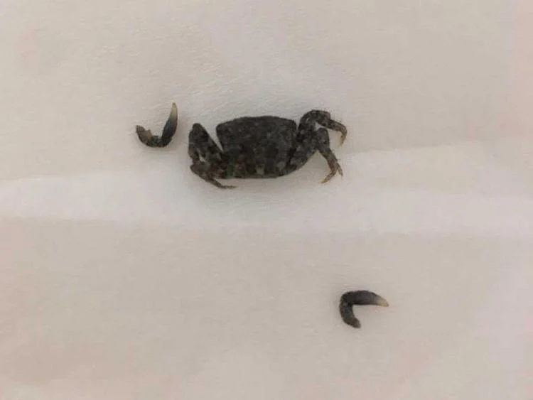 Baby crab in ear