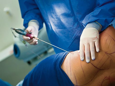 New rules make cosmetic procedure safer in Dubai