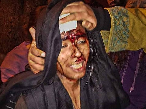  JNUSU President Aishe Ghosh is seen injured after being attacked in JNU