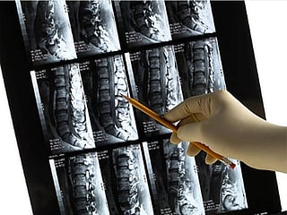 Is your lifestyle affecting your bone health?