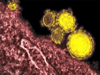 Coronavirus: Saudi Arabia reports 5 new cases