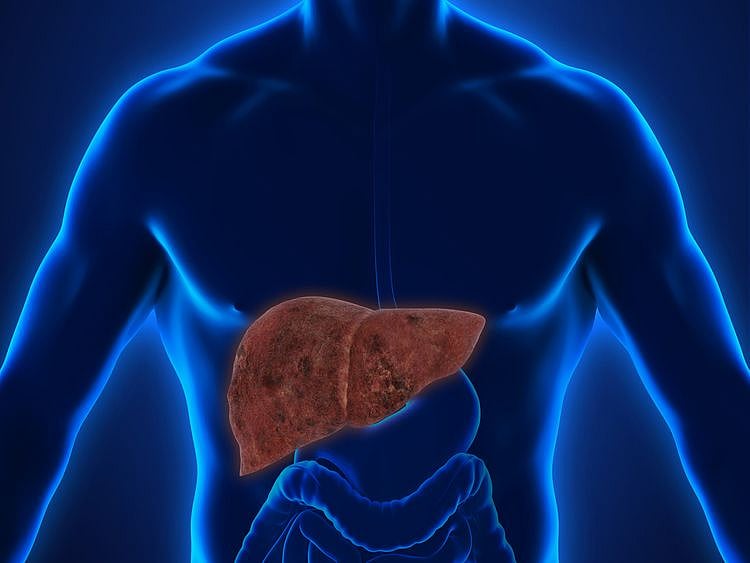 Dubai Health Authority fatty liver disease