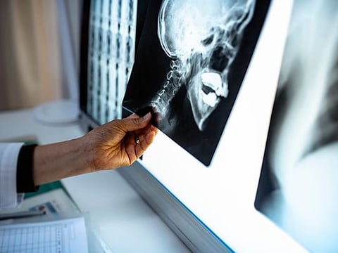  Scientists have made a new discovery of a pair of large salivary glands lurking in the nook where the nasal cavity meets the throat.