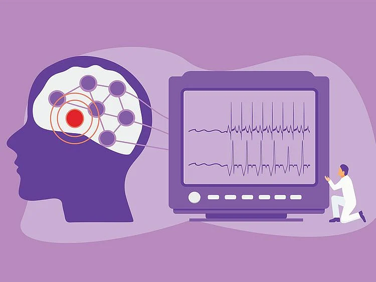 Dubai Health Authority Epilepsy