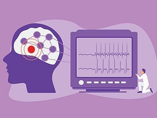 DHA highlights epilepsy services