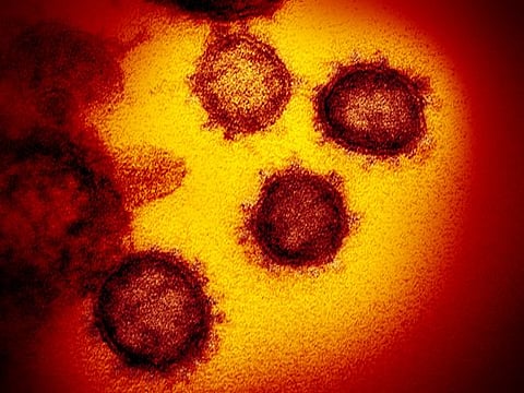 Most detailed picture of deadly novel coronavirus