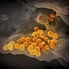 Copy of Coronavirus_Outbreak_97077.jpg-a5f96-1582443426108