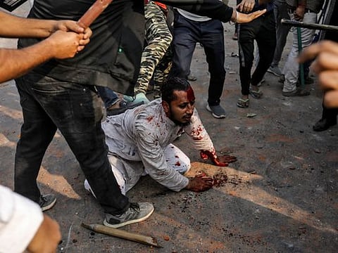 Delhi burning, bleeding in Citizenship Amendment Act protests 