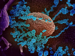 CIA shifts view on Covid-19 cause with lab leak as ‘more likely’