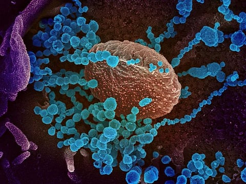A handout illustration image courtesy of the National Institutes of Health taken with a scanning electron microscope shows SARS-CoV-2 (round blue objects) emerging from the surface of cells cultured in the lab. SARS-CoV-2 is the virus that causes COVID-19.