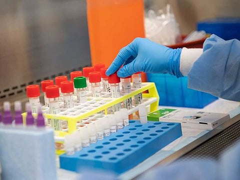 A lab technician Northwell Labs begins semi-automated testing for COVID-19 at Northwell Health Labs on March 11, 2020 in Lake Success, New York. An emergency use authorization to the FDA allows Northwell to move from manual testing to semi-automated.   Andrew Theodorakis/Getty Images/AFP 