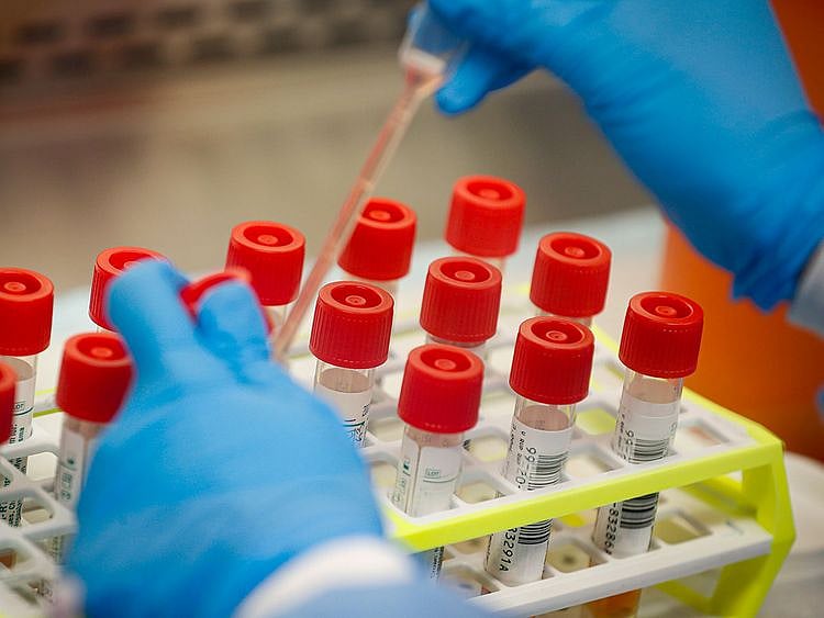 A technician prepares COVID-19 coronavirus patient samples for testing at a laboratory in New York's Long Island. 