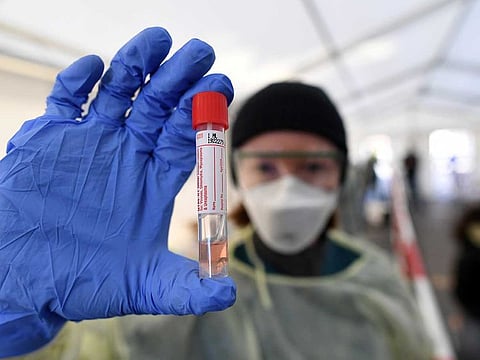 A medical employee presents a smear taken at a special corona test centre for public service employees such as police officers, nurses and firefighters during a media presentation as the spread of the coronavirus disease (COVID-19) continues, in Munich, Germany, March 23, 2020.