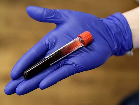A phlebotomist holds freshly donated blood during a Bloodworks Northwest blood drive at the Shoreline Masonic Lodge in Shoreline, Washington, US on March 15, 2020.