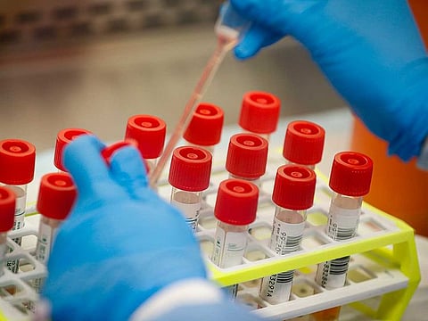 A technician prepares COVID-19 coronavirus patient samples for testing at a laboratory in New York's Long Island. 
