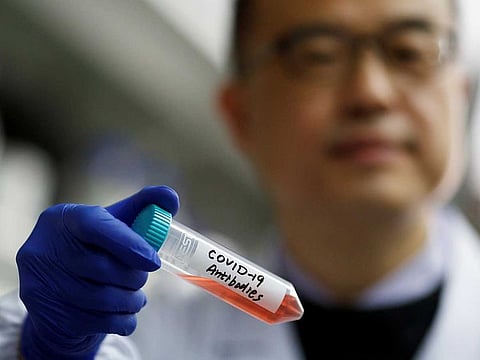 Scientist Linqi Zhang shows a tube with a solution containing COVID-19 antibodies in his lab where he researches for a possible drug, at Tsinghua University's Research Centre for Public Health in Beijing, China, on March 30, 2020.