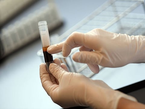Sonja Krauthoefer of the University Hospital Erlangen checks donated blood and plasma samples