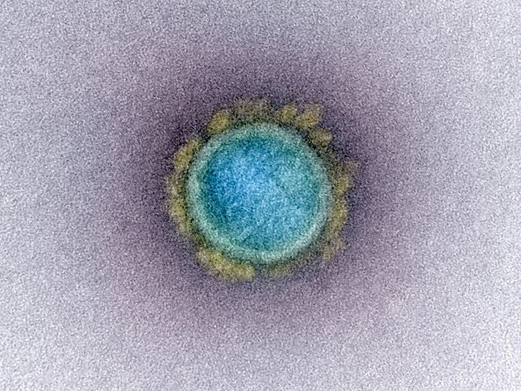 Coronavirus_Mug shot