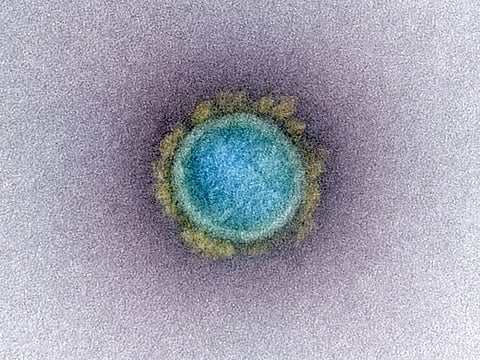 A transmission electron micrograph of a SARS-CoV-2 virus particle, also known as novel coronavirus, the virus which causes COVID-19, isolated from a patient. 
