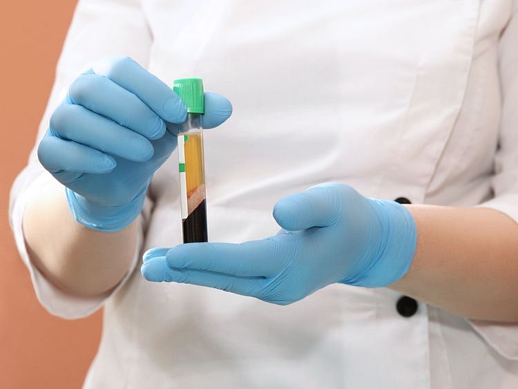NAT STOCK PLASMA BLOOD-1586614954590
