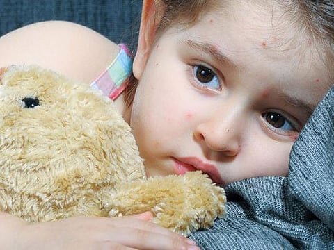 What does your child's rash mean?