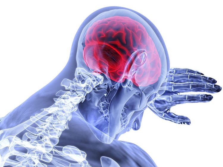 Brain inflammation, generic