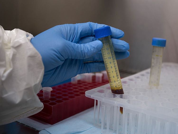 Researchers develop molecule for potential COVID-19 drug in India