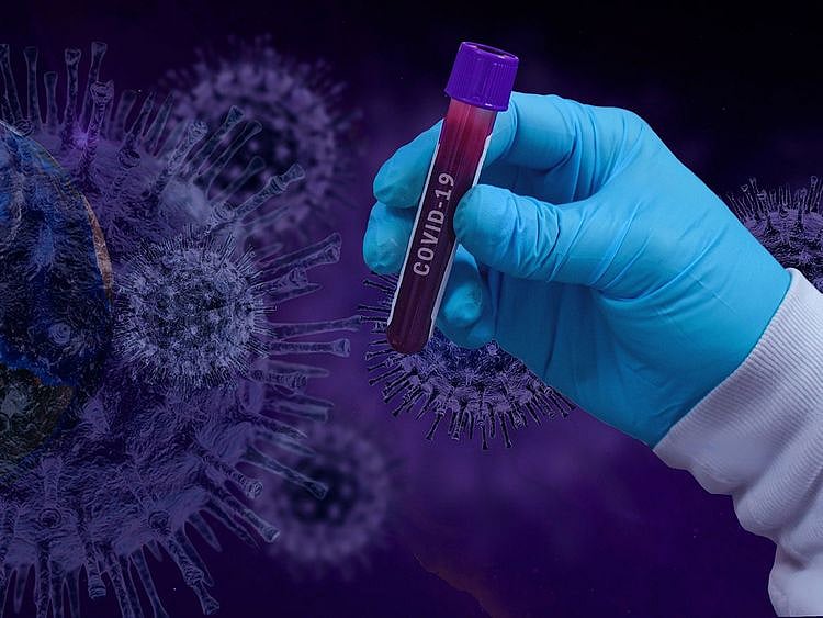 Coronavirus generic
