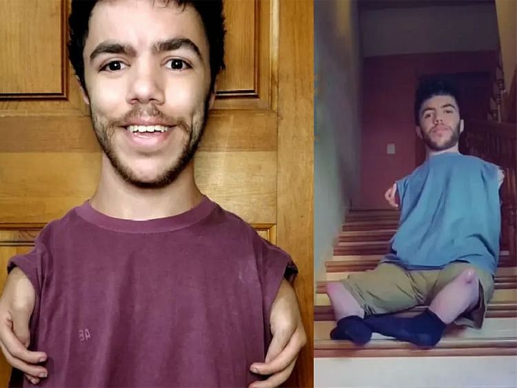 TikTok sensation @armlessfreak