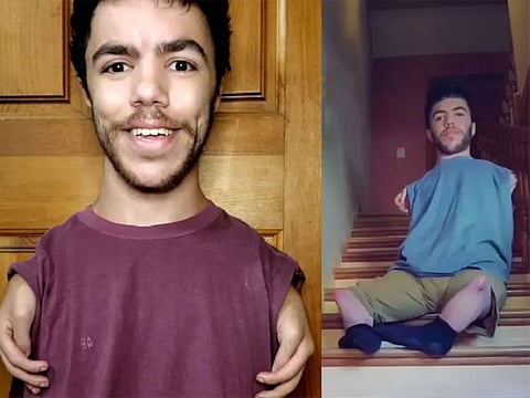 TikTok sensation @armlessfreak