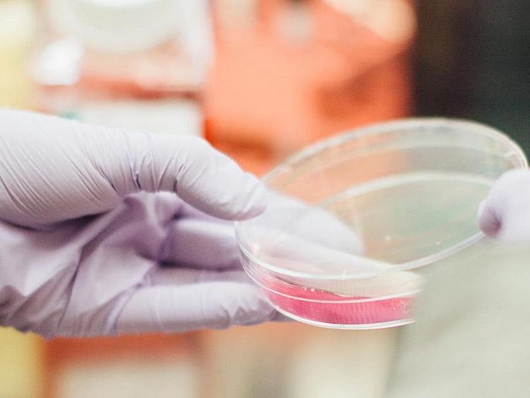 BC Bacteria to avoid when pregnant