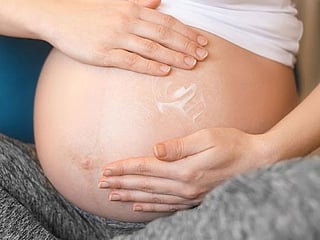 Pregnant in UAE: How to avoid getting stretch marks during pregnancy 