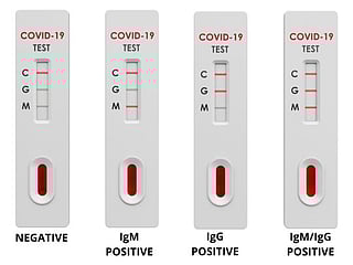 Rapid COVID-19 tests: What negative or positive results mean