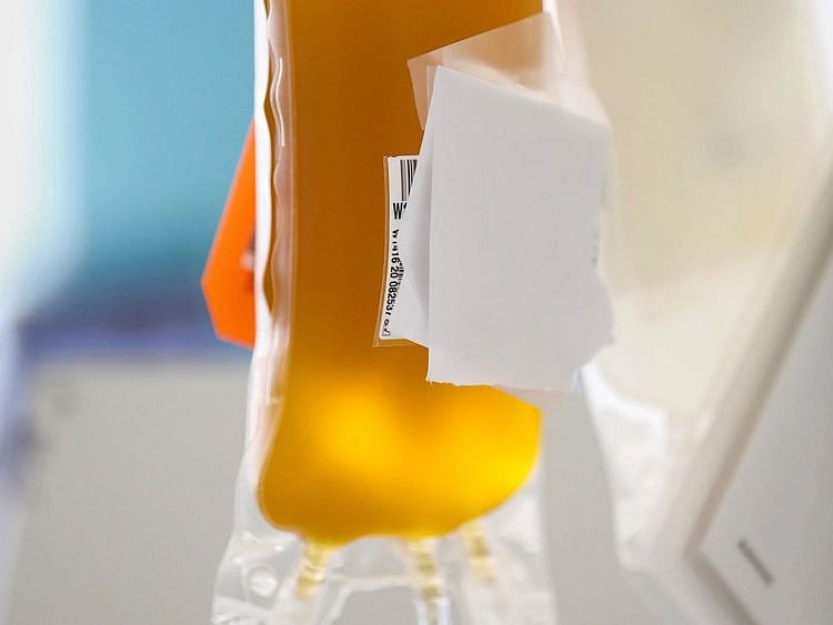 convalescent plasma therapy cpt