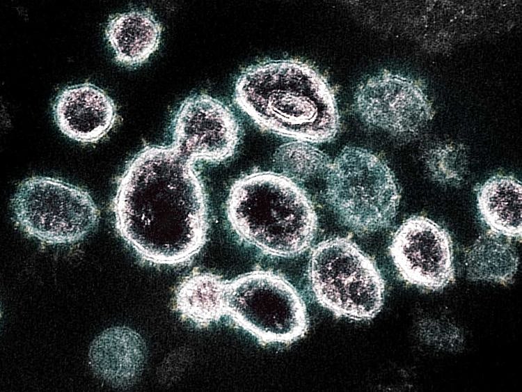 OPN_Coronavirus_image
