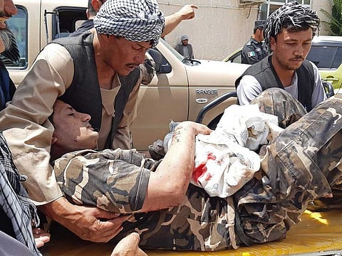 A wounded personnel of National Directorate of Security (NDS) is brought on a stretcher to a hospital after a car bomb exploded in the city of Aybak, in Samangan province on July 13, 2020. A car bomb claimed by the Taliban exploded on July 13 near the offices of Afghanistan's intelligence agency in the north of the country, wounding dozens of people, officials said. 